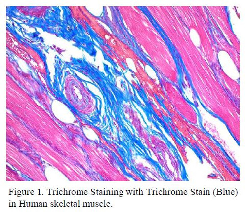 Trichrome Stain (Blue) Histology Stain, 500mL
