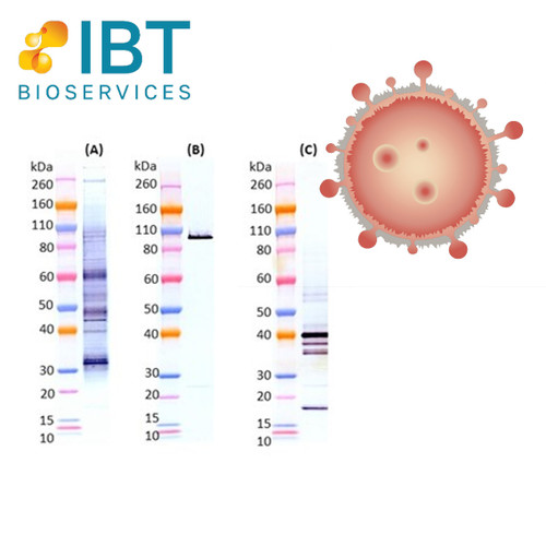 Integrated Biotherapeutics Severe Acute Respiratory Syndrome, SARS-CoV-2 Virus-like particle, Epsilon (B.1.429), 1x Conc. 25 x 200uL (~100 wells) 