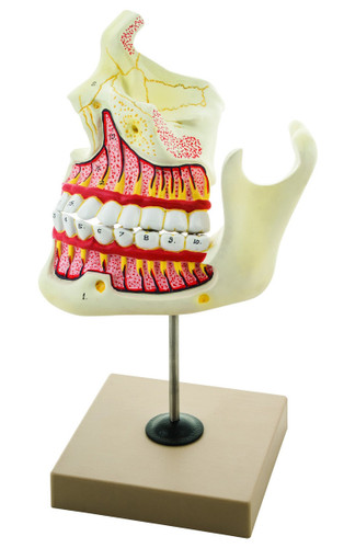 Eisco Labs Anatomical Model, Upper and Lower Jaw, 4 Times Enlarged, Mounted on stand 