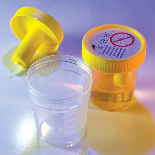 TransferTop Urine Collection Cup with Integrated Transfer Device, 4oz (120mL), Graduated, Sterile, Bulk, case/300