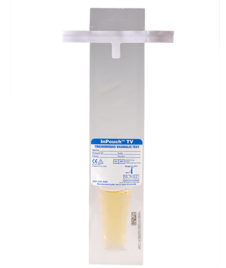 trichomonas culture