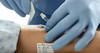 BD 2000E SmartSite Needle-Free Valve, 0.11 ml PV, Stand Alone, 100/cs (Continental US Only) , case