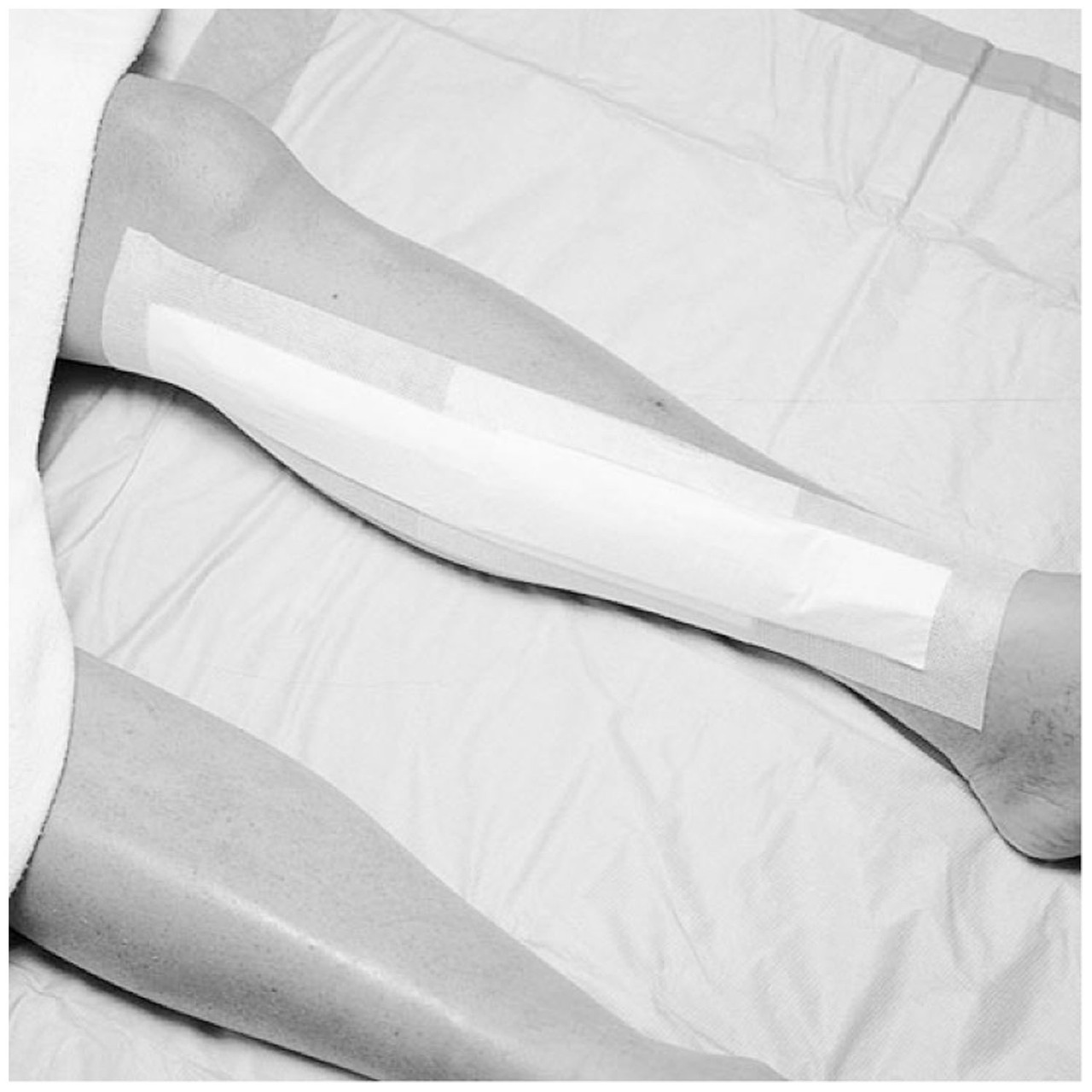 medipore dressing 3M 3566 Adhesive Box of 25 Perforated Medical Tape 3M Medipore