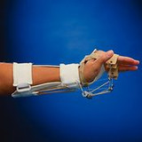 A8321 Performance Health Rolyan Adjustable Outrigger Kit for MCP Flexion