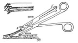 PM-390 Integra Miltex D'Assumpcao Rhytidoplasty Marker,6-1/4,w/o Ratchet