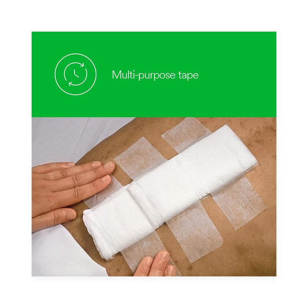 Solventum Corporation MICROPORE™ 1530-3 Paper Surgical Tape, 3\in. x 10 yds, 4 rl/bx, 10 bx/cs (Continental US+HI Only) , case