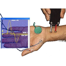 023404 Natus - Nicolet Neurodiagnostic Vol V: Basic Nerve Conduction Studies (1-year sub)