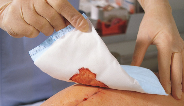 Hartmann USA, Inc. USA SORBALUXÃ‚Â® 48700000 ABD Pad, 5in. x 9in., Sterile, Latex Free (LF), 25/bx, 16 bx/cs , case