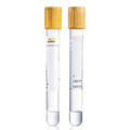 Bridge Global Health p/n 623050202 Improvacuter Gel & Clot Activator Tube, 5ml / 13 x 100 mm, Gold Top, 1000/cs - comparable to BD 367986