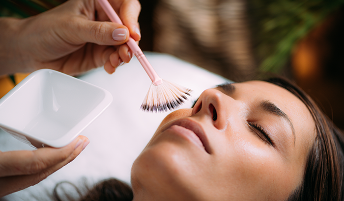 What Do TCA Chemical Peels Do?