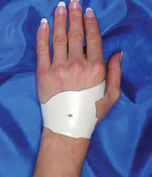 IMPACTO Carpal Control - Relief From Carpal Tunnel Syndrome (CTS)