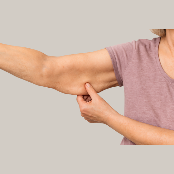 Density (Arms Package of 4)