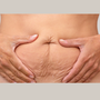 Density (Abdomen)