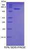 Human Recombinant Activated Leukocyte Cell Adhesion Molecule (ALCAM)