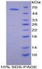 Mouse Recombinant Activated Leukocyte Cell Adhesion Molecule (ALCAM)