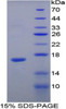 Rat Recombinant Angiogenin (ANG)