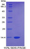 Human Recombinant Connective Tissue Growth Factor (CTGF)