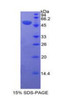 Human Recombinant Erythropoietin Receptor (EPOR)