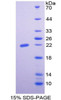 Rat Recombinant Erythropoietin (EPO)