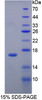 Rabbit Recombinant Selectin, Endothelium (SELE)