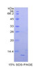 Mouse Recombinant Neutrophil Activating Protein 3 (NAP3)