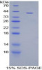 Rat Recombinant Insulin Like Growth Factor 1 (IGF1)