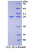 Human Recombinant Insulin Like Growth Factor Binding Protein 1 (IGFBP1)