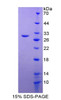 Mouse Recombinant Insulin Like Growth Factor Binding Protein 4 (IGFBP4)