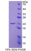 Human Recombinant Interleukin 10 (IL10)