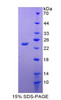 Rabbit Recombinant Interleukin 18 (IL18)