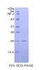 Mouse Recombinant N-Acetyl Beta-D-Glucosaminidase (NAGase)