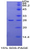 Rat Recombinant N-Acetyl Beta-D-Glucosaminidase (NAGase)