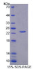 Human Recombinant Interleukin 1 Alpha (IL1a)