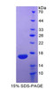 Human Recombinant Interleukin 5 (IL5)