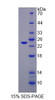 Mouse Recombinant Leptin Receptor (LEPR)