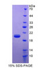 Rat Recombinant Leptin (LEP)