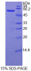 Human Recombinant Selectin, Leukocyte (SELL)