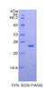 Mouse Recombinant Macrophage Inflammatory Protein 1 Beta (MIP1b)