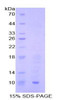 Rat Recombinant Macrophage Inflammatory Protein 3 Beta (MIP3b)