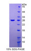 Human Recombinant Tyrosine Kinase With Immunoglobulin Like And EGF Like Domains Protein 1 (Tie1)