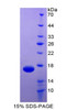 Human Recombinant TEK Tyrosine Kinase, Endothelial (Tie2)