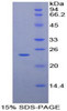 Human Recombinant Tissue Inhibitors Of Metalloproteinase 2 (TIMP2)