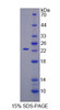 Rat Recombinant Tissue Inhibitors Of Metalloproteinase 2 (TIMP2)