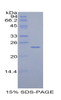 Rat Recombinant Tissue Inhibitors Of Metalloproteinase 4 (TIMP4)