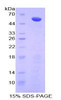 Human Recombinant Adiponectin Receptor 2 (ADIPOR2)