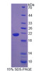 Rat Recombinant AdiPonectin Receptor 2 (ADIPoR2)