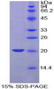 Pig Recombinant Plasminogen Activator, Urokinase (uPA)