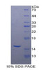 Human Recombinant Carcinoembryonic Antigen (CEA)