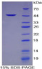 Pig Recombinant Alpha-Fetoprotein (aFP)