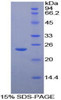 Human Recombinant Galactosidase Beta (GLb)